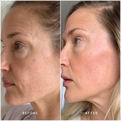 True Botanicals Collagen Boosting Essentials Set |Increase Hydration, Treat Fine Lines & Wrinkles | Contains Ginger Turmeric Cleansing Balm, Chebula Active Serum, & Chebula MultiCorrective Eye Patches