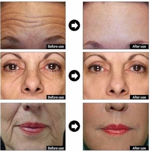 Matrixyl 3000 + Argireline, Vitamin C, Hyaluronic Acid Serum, Anti-Aging Face Serum, Anti-Wrinkle Serum for face, Multi Peptide Firming Serum - 8oz