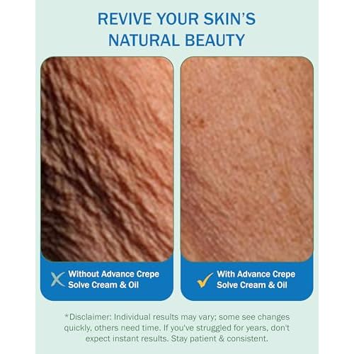 Crepe Skin Erase Cream & Firming Oil Set (2 Pk, 4 Fl Oz each) - with Natural Oils, Licorice Root & Chamomile Extract - Crepey Skin Tightening and Firming Body Cream & Oil, Made in USA