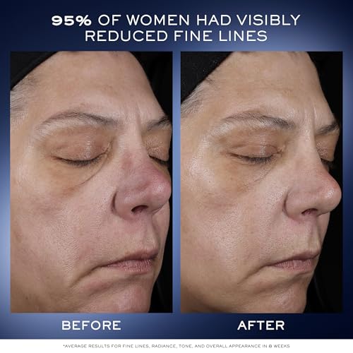 Lanc?me G?nifique Ultimate Dual Recovery Face Serum- Anti-Aging Serum Visibly Improves Fine Lines, Rough Texture, Plumpness and Even Skintone - with Beta Glucan and, Hyaluronic Acid