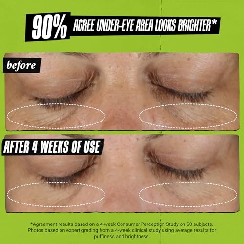 Kiehl's Avocado Eye Treatment, Nourishing and Hydrating Eye Cream, Avocado Oil and Caffeine to Energize and Invigorate Skin, Tired Eyes, 99% Naturally Derived Formula