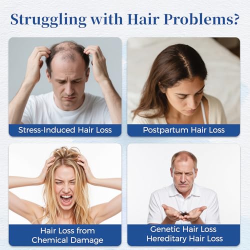 Hair Growth Serum Roll On 25ml/0.84Oz with Saw Palmetto, Rosemary & Pea Extract£¬Helps Support Thicker, Fuller Hair Appearance, Non-Greasy Hair Loss Support for Men & Women (2pcs)