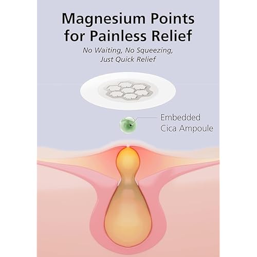EasyDerm Quick Calming Magnesium Patches ? 40 Patches (4 Pack), Hydrocolloid Acne Spot Treatment with Tea Tree & Cica, Bulk Value Pack for Acne-Prone Skin, Ideal for Home Skincare