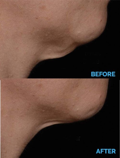 AminoGenesis N.E.C.K Control: Neck Lifting, Firming And Retracting Cream