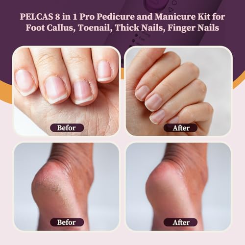 PELCAS Toenail Grinder for Thick Toenails 8 in 1 Manicure & Pedicure Kit, 5 Speeds Cordless Nail Drill with LED Light Electric Foot Callus Remover for Foot Callus, Thick Nails, Finger Nails Pink