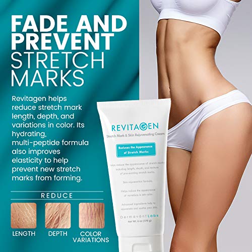 Bundle with Revitagen - For Reducing Cellulite + Stretch Marks - Restore Tight Smooth Skin (2 Items)#