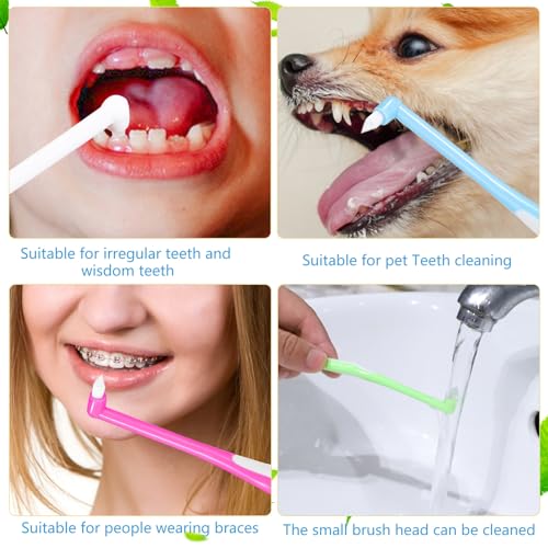 8 Pieces End Tuft Toothbrush with Cover, Soft Interdental Brushes Tapered Brush Braces Toothbrush for Orthodontic Braces Detail Cleaning(Blue/Green/Rose Red/White)