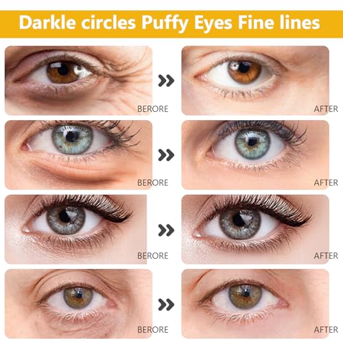 15 Pairs Collagen Crystal Eye Mask and 15 Pcs Collagen Crystal Lip Mask, Under Eye Patches and Lip Pads,Collagen Crystal Mask Set for Moisturizing, Reducing Fine Lines & Dark Circles (Gold and Pink)