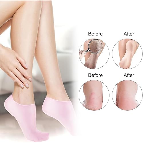 4 Pairs Silicone Moisturizing Glove Socks Set for Dry Cracked Feet and Hands, Anti Slip Spa Socks Women Gel Pedicure Socks for Foot Hand Softening Foot Care After Pedicure