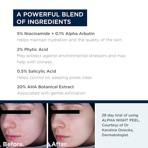 ALPHASCIENCE Alpha Night Peel ? Unifying, Resurfacing Serum - Helps Smooth Uneven Skin - for Oily & Acne Prone Skin and Fine Lines and Wrinkles - 30 ml / 1 fl. oz.