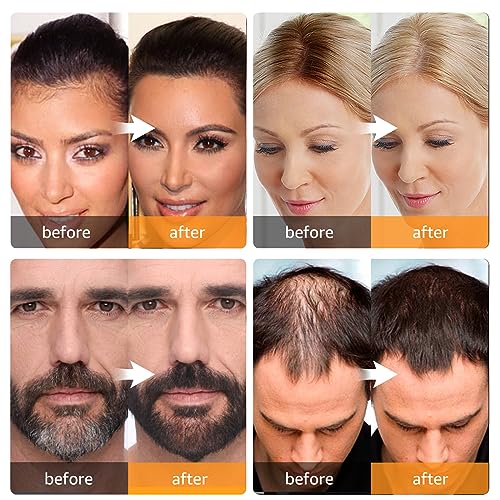 Root Touch Up Instantly Gray Hair Coverage Hairline Powder for Women & Men, Medium Brown for Concealing Hair Loss & Thinning Hair