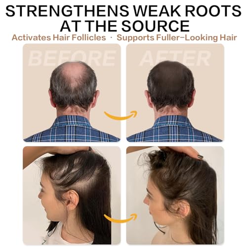 Root Activator Shampoo for Men and Women ? Rosemary & Boiton Hair Growth Shampoo for Thinning Hair, Hair Loss & Scalp Health ? Natural Herbal Formula with Cooling Sensation ? Sulfate-Free ? 10.1 fl oz