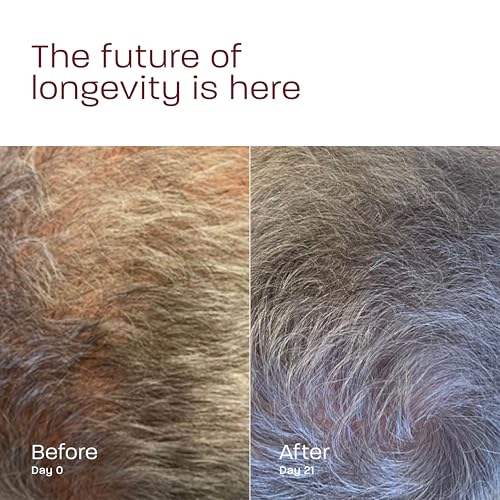 Genesis Formula Day & Night Dual Act Scalp Serum ? Biointelligent Hair Loss Protection & Regrowth with Bio-Engineered Exosomes, 2x1 fl oz