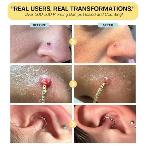 BASE LABORATORIES Piercing Bump Solution & Keloid Bump Removal | Soothing Piercing Aftercare for Piercing Bumps & Keloid Scar Removal | Ear & Nose Keloid Bumps Piercing Aftercare Solution Oil | 0.5 oz