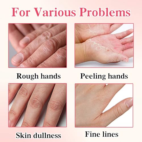 6 Pcs Hand Masks Moisturizing Glove, Hydrating Hand Mask for Dry cracked Hands, Exfoliating Collagen Gloves for Smooth Hands, Smooth Exfoliating Hand Peeling Mask
