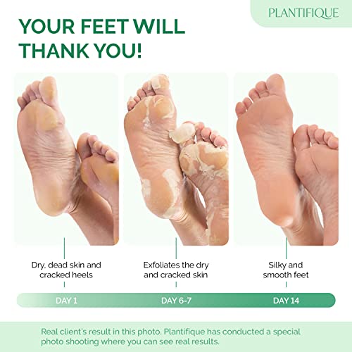 PLANTIFIQUE Foot Peeling Mask 2 Pack | Dermatologically Tested Repairs Heels & Removes Dry Dead Skin for Baby Soft Feet | Exfoliating Foot Peel Mask for Dry Cracked Feet | Peach