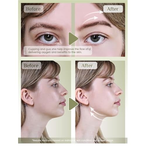 Rena Chris Facial Cupping Set & Gua Sha Facial Tool - Silicone Cupping Set & Jade Gua Sha Stone - Face Cupping Therapy Set for Natural Skin Care, Puffiness, Lip Plumping(Green)