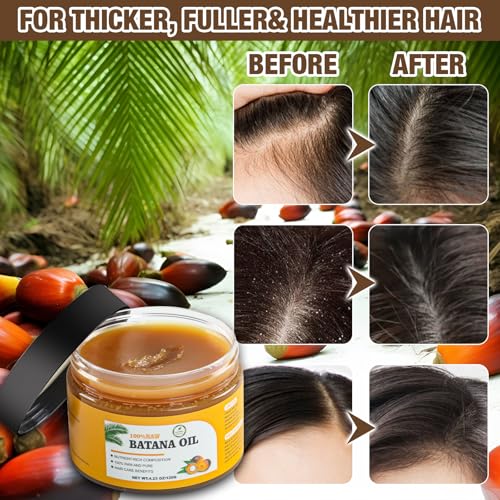 Andreyt Raw Batana Oil for Hair Growth, 100% Natural Pure Dr. Sebi Batana Oil from Honduras, Prevent Hair Loss, Promotes Hair Growth and Thickness for Men & Women