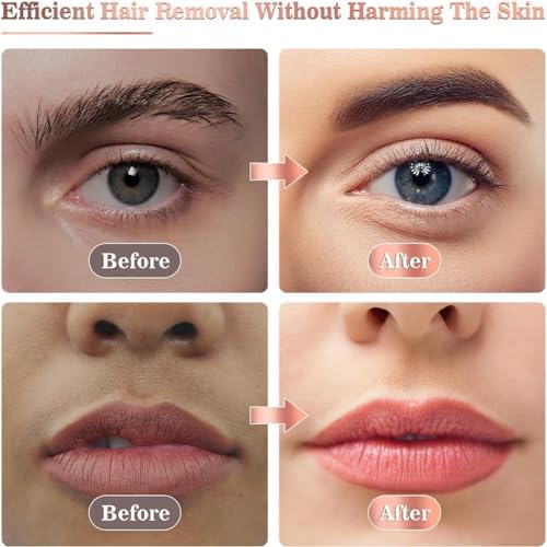 Facial Hair Removal for Women, Portable Lady Shaver, Rechargeable Painless Hair Remover for Face, Upper Lips, Chin, Peach Fuzz-Model A