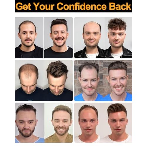 BEEOS 0.10mm Durable PU Skin Toupee for Men, 130% Medium Density Volume Human Hair System No Shed, 8x10 Inch Mens Hair Piece #3 Brown
