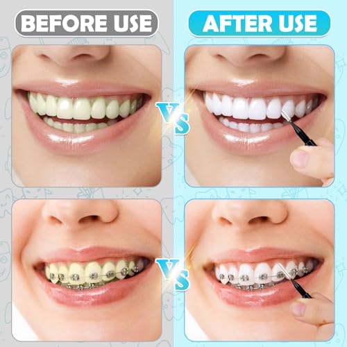 Modacraft 120Pcs Interdental Brushes, Deep Cleaning Braces Flossers for Braces Orthodontic with Soft Bristles 360¡Æ Bendable Floss Heads Dental Brushes Between Teeth Gum Braces Oral Cleaning Tool Kit