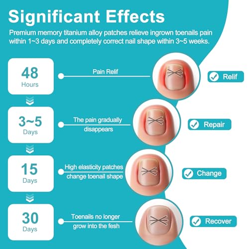 Ingrown Toenail Treatment Kit with Upgraded 6-Angle Shape,Titanium Alloy Ingrown Nail Corrector Tools with 4 Multi-Sizes,Ingrown Toe Nail Relief Remover Strips for Curved Toenail Quick Relief,8Pcs