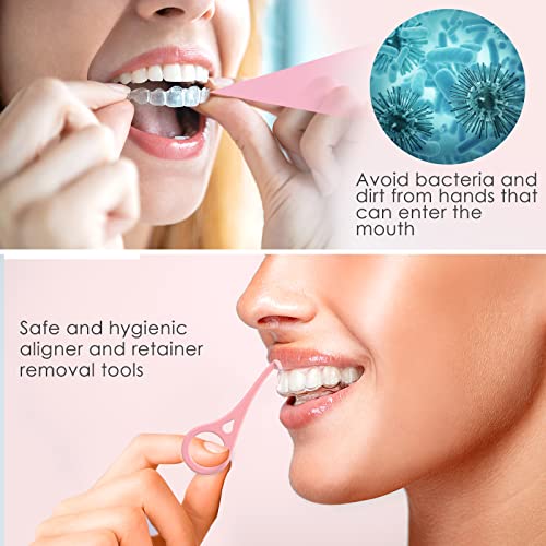 ARGOMAX - Aligner Removal Tool, 50 Invisible Braces Removal Tools, Retainer Remover Tool, Suitable for Removing Braces, Trays, Retainers, Dentures and Aligners(Pink).