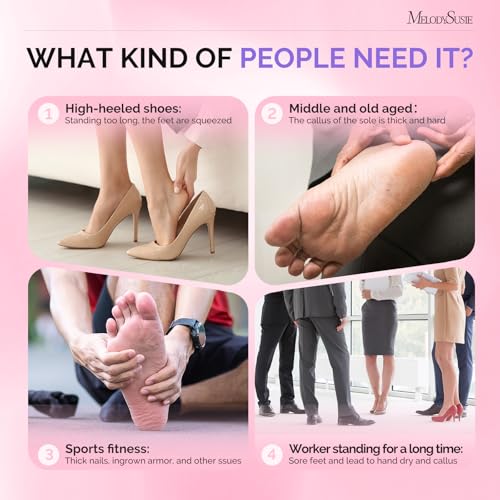 MelodySusie 80PCS Replacement Sandpaper Discs with 25mm Metal Nail Drill Bit, 80 Coarse 150 Medium 240 Extreme Fine Grit for Electric Foot File Callus Remover Tool or Polishing Craft