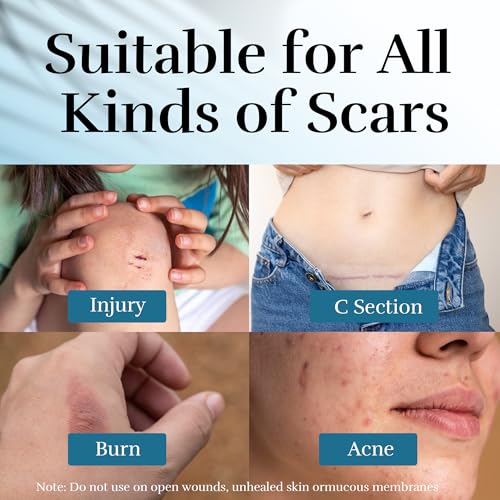 Advanced Scar Cream, Scar Reduction Treatment for Improves Skin Texture & Helps Remove Acne, Stretch Marks, Surgery, C Section, Burn, Keloid & Hypertrophic Scars 1.76 Oz (50g)