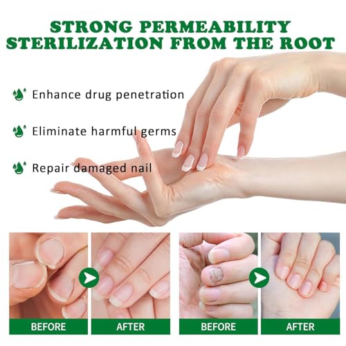 Natural Nail Treatment Gel, Nail Growth Serum for Repair & Strengthener (2)