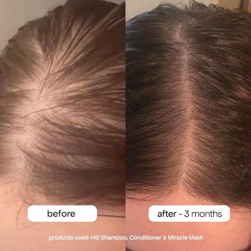 BondiBoost HG Anti-Thinning Shampoo Conditioner Set [16.90 fl oz each], Clinically Tested to Promote Fuller + Thicker-Looking Hair for Women & Men, Procapil, Redensyl & Rosemary Formula, Sulfate-Free