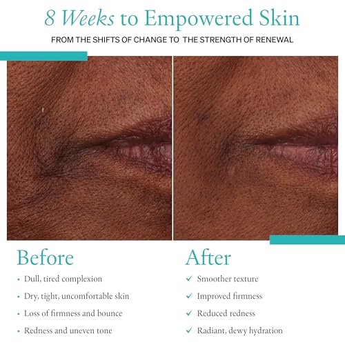 Calm Deep Hydration Restorative Cream ? Unrivaled Hydration for Perimenopausal and Menopausal Skin ? Facial Moisturizer for Women, Daily Face Cream for Dry, Sensitive Skin ? 50ml