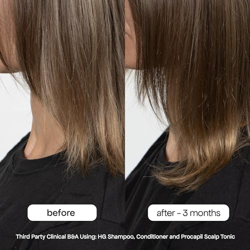BONDIBOOST HG Anti-Thinning Hair Conditioner [10.14 fl oz] - Hydrating Hair Conditioner with Aloe Vera, Rosemary & Saw Palmetto, Promotes Thicker + Stronger-Looking Hair for Men & Women, Sulfate-Free