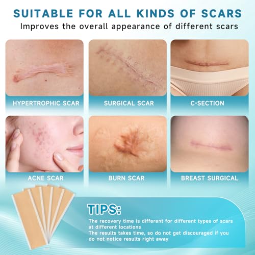 Silicone Scar Sheets, Silicone Scar Tape(5.7" x 1.57"10 Pcs) Silicone Scar Strips, Professional Scar Removal Sheets for Surgical Scars, Keloid, C-Section, Burn et