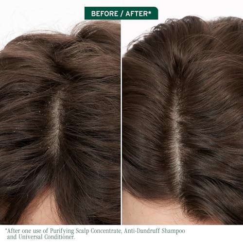Biolage Scalp Sync Purifying Concentrate - Exfoliating & Clarifying Dry Scalp Treatment, Refreshing & Reinvigorating, Fermented Tea Blend & Glycolic Acid