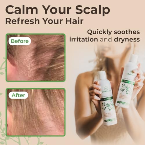 Eczema Psoriasis Anti-Dandruff & Seborrheic Dermatitis Shampoo Set for Dry, Itchy Scalp & Hair Treatment - For Men & Women