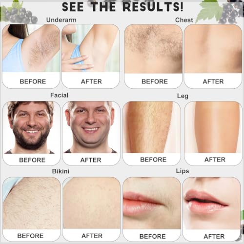 2.5 lb Bulk Sensitive Skin Wax Beads for Hair Removal, Waxing Beads for Coarse and Fine Hair, Gentle Formula for Body Brazilian Waxing, Bikini Face Leg Underarm Back Chest, Includes 20 Sticks