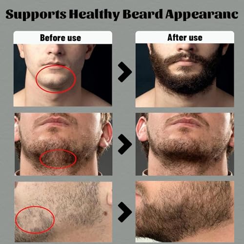 Para Barba, Crecimiento De Barba Para Hombre, Estimulante De Barba, Estimulante De Barba Ultra Potente, Balsamo Negro Moisturizes Strengthens Barba for Mens (2PCS)