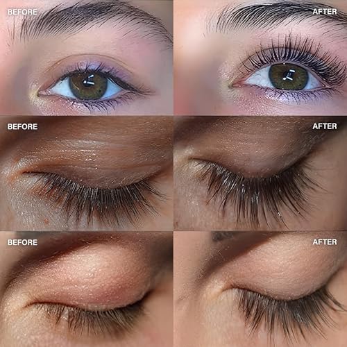 ForChics 2 in 1 Lash and Brow Growth Serum - Hormone-Free Enhancer for Thicker, Longer Lashes and Brows in 2 Weeks - Organic, Vegan and Gentle