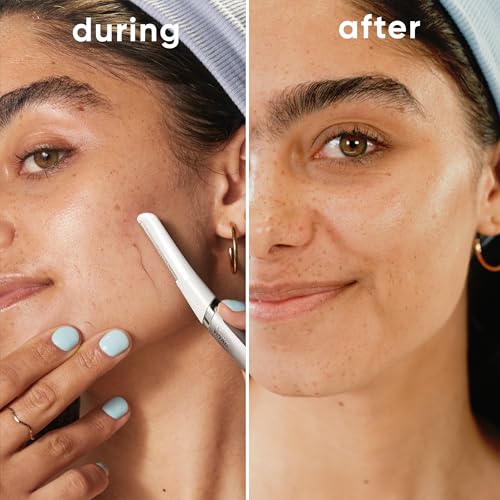 Gillette Venus Facial Razor, Exfoliating Dermaplaning Tool for Face, Replaceable Refills, Removes Fine Facial Hair, Exfoliates Dead Skin, Skin Defense Guard, Handle with 5 Blade Refills