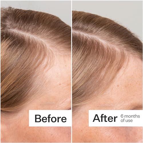 Act+Acre 3-Pack Mini Cold Processed Stem Cell Scalp Serum - Promotes Thicker, Fuller-Looking Hair - Soothes and Hydrates - Sulphate and Paraben Free - Aloe Vera for Improved Scalp Health