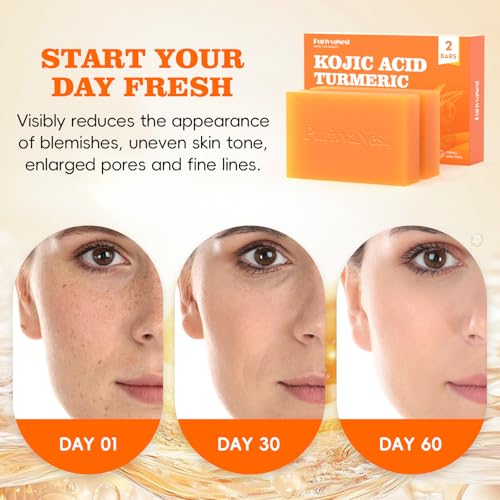 Turmeric Soap Bar Dark Spot Kojic Acid soap Remover for face and body Even Skin Tone, Moisturizing & Nourishing Natural Ingredients£¨2Pack£©
