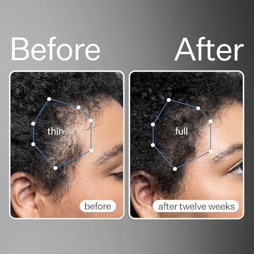 Act+Acre 3-Pack Mini Cold Processed Stem Cell Scalp Serum - Promotes Thicker, Fuller-Looking Hair - Soothes and Hydrates - Sulphate and Paraben Free - Aloe Vera for Improved Scalp Health