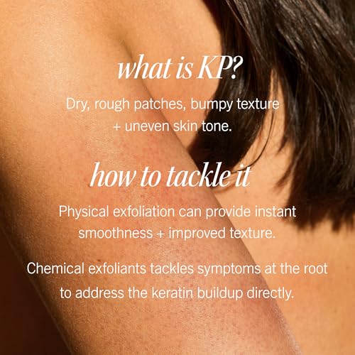 First Aid Beauty - KP Bump Eraser Body Scrub with 10% AHA, Keratosis Pilaris Skin Exfoliater with Glycolic and Lactic acids, Helps Reduce Chicken Skin Bumps, Safe for Sensitive Skin, 4 oz
