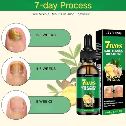 Ginger Nail Treatment, Ginger Cuticle Care Oil for Nails (2 PCS)