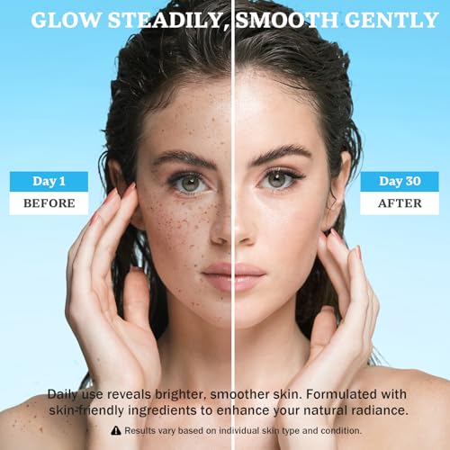 Dark Spot Remover for Face and Body: Dark Spot Corrector Cream, Melasma, Freckle, Sun Spot, Age Spot Remover with Niacinamide and Vitamin C, Advanced Formula for Women and Men (1.7 Fl Oz)