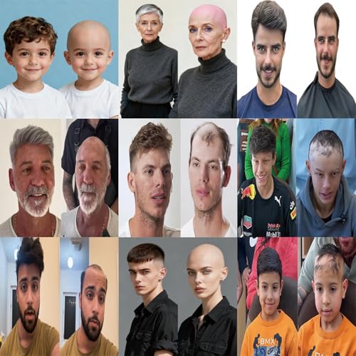 Skinlike Real HD Lace Human Hair Toupee for Men, 8x10 Inch Lace Front with Thin Skin Back and Side Q6B Mens Hair Piece, Mens Wig 1B# Natural Black