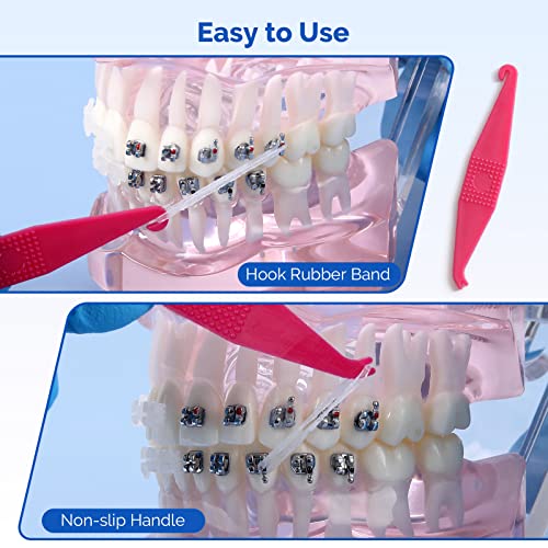 JMU Orthodontic Rubber Bands 1/4 Medium 6.4 mm Clear Orthodontic Elastics 4.5oz 500 pack Latex Free Dental Rubber Bands Made in USA