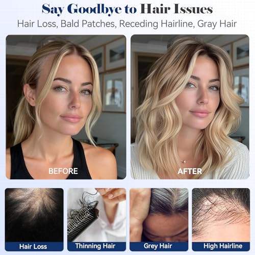 HAIRCUBE Human Hair Toppers For Women 6"*5" Large Base Real Human Hair With Thinning, 14 Inch For Hand-Woven, 60g, Use Daily, Hairloss, Ombre Light Ash Blonde, With Bangs