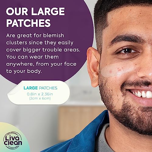 LivaClean LC ?????? ????, ?? ???????? Large Hydrocolloid Acne Patches - for Pore Spots Nose Face Cystic Pimple Zit Patch - Big Pimple Patches Hydrocolloid Bandages Strips Stickers Patch XL Large Acne